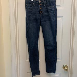 Madewell button up skinny jeans.